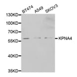 Anti-KPNA4 Antibody from Bioworld Technology (BS7413) - Antibodies.com