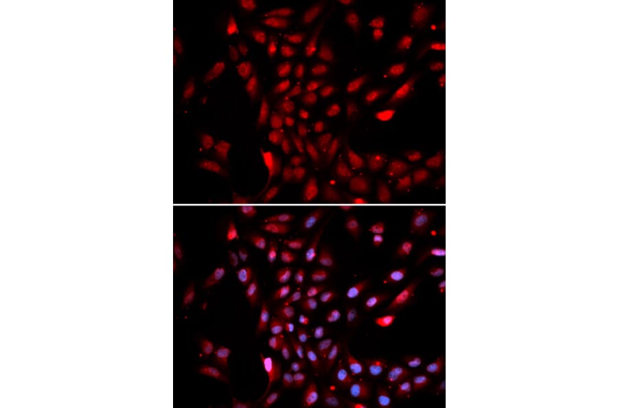 Anti-KPNA4 Antibody from Bioworld Technology (BS7413) - Antibodies.com
