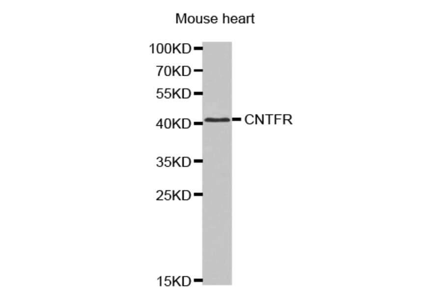 Anti-CNTFR Antibody from Bioworld Technology (BS7424) - Antibodies.com