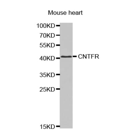 Anti-CNTFR Antibody from Bioworld Technology (BS7424) - Antibodies.com