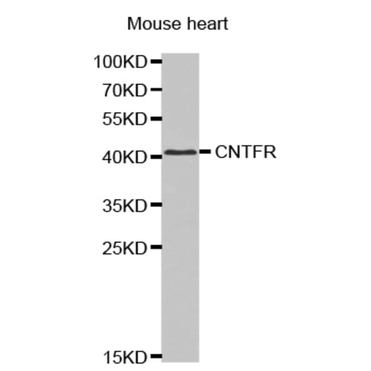 Anti-CNTFR Antibody from Bioworld Technology (BS7424) - Antibodies.com