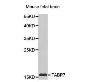Anti-FABP7 Antibody from Bioworld Technology (BS7428) - Antibodies.com