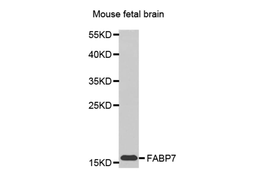 Anti-FABP7 Antibody from Bioworld Technology (BS7428) - Antibodies.com