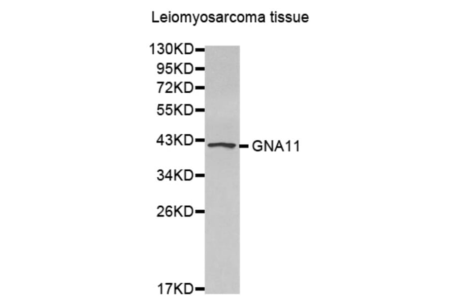 Anti-GNA11 Antibody from Bioworld Technology (BS7429) - Antibodies.com