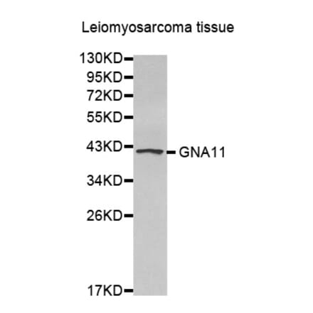 Anti-GNA11 Antibody from Bioworld Technology (BS7429) - Antibodies.com