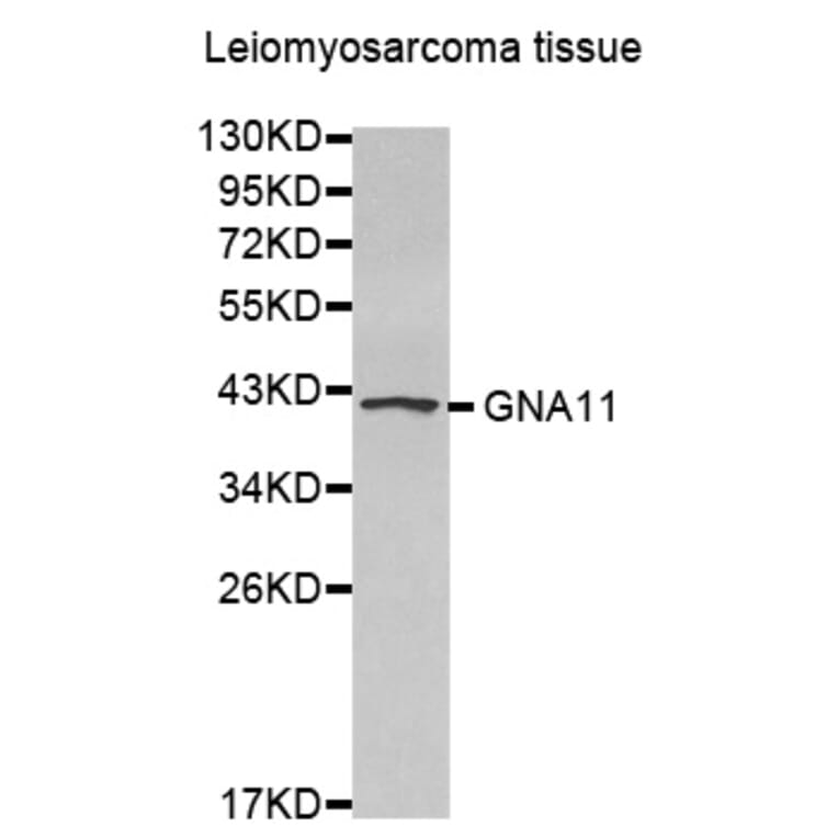 Anti-GNA11 Antibody from Bioworld Technology (BS7429) - Antibodies.com