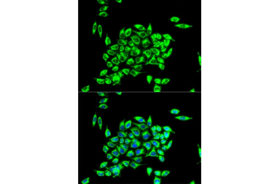 Anti-TRAP1 Antibody from Bioworld Technology (BS7433) - Antibodies.com