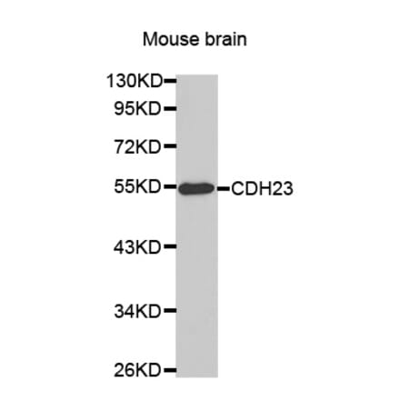 Anti-CDH23 Antibody from Bioworld Technology (BS7438) - Antibodies.com