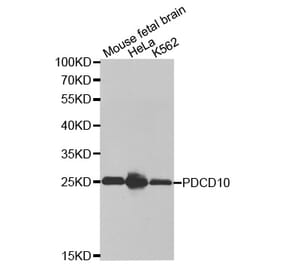 Anti-PDCD10 Antibody from Bioworld Technology (BS7439) - Antibodies.com
