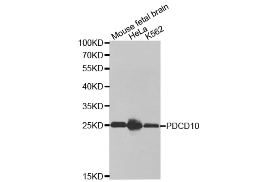 Anti-PDCD10 Antibody from Bioworld Technology (BS7439) - Antibodies.com