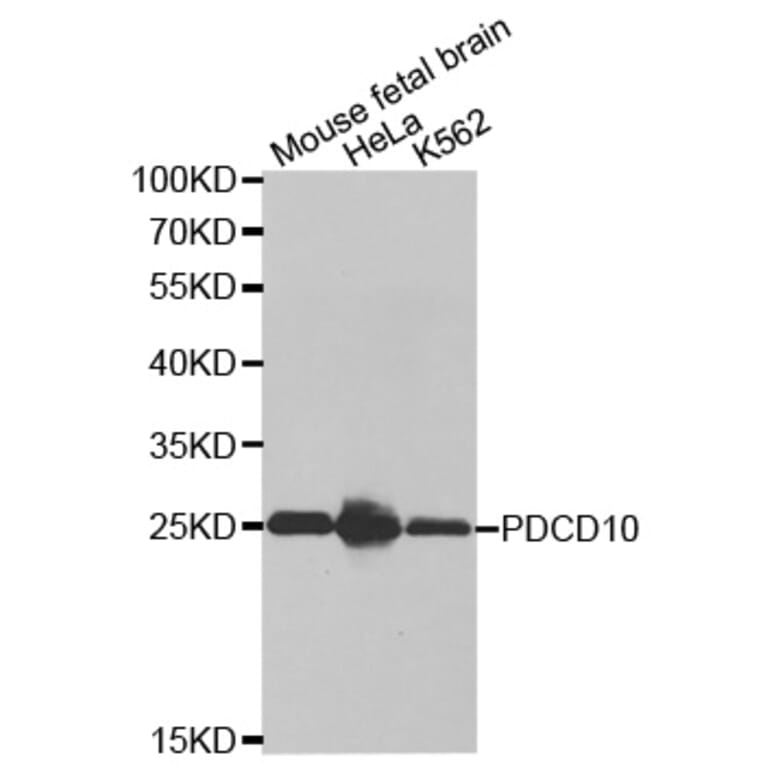 Anti-PDCD10 Antibody from Bioworld Technology (BS7439) - Antibodies.com