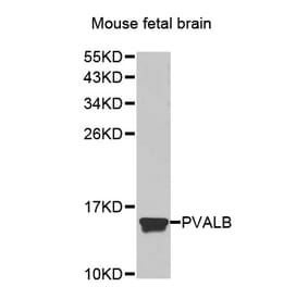 Anti-PVALB Antibody from Bioworld Technology (BS7440) - Antibodies.com