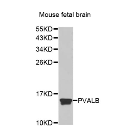 Anti-PVALB Antibody from Bioworld Technology (BS7440) - Antibodies.com