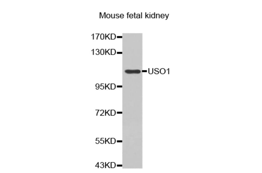 Anti-USO1 Antibody from Bioworld Technology (BS7441) - Antibodies.com
