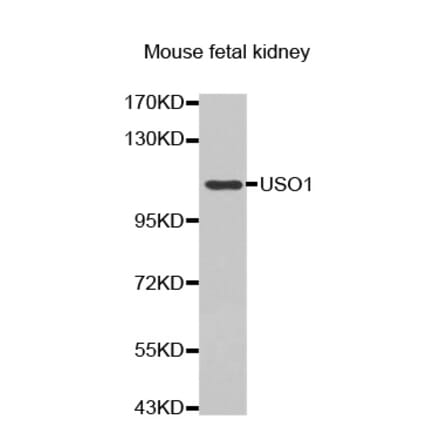 Anti-USO1 Antibody from Bioworld Technology (BS7441) - Antibodies.com