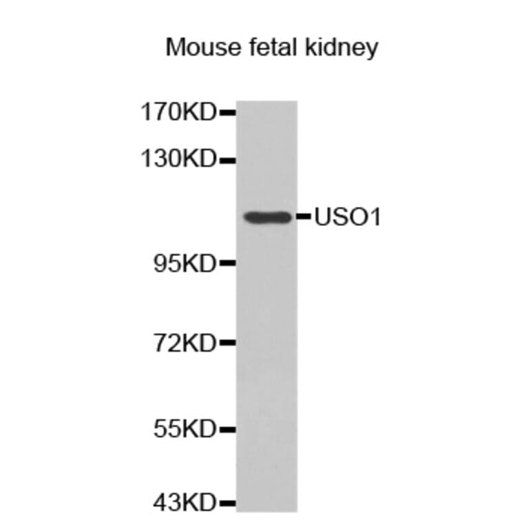 Anti-USO1 Antibody from Bioworld Technology (BS7441) - Antibodies.com