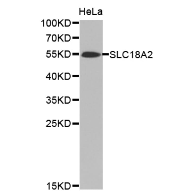 Anti-SLC18A2 Antibody from Bioworld Technology (BS7442) - Antibodies.com
