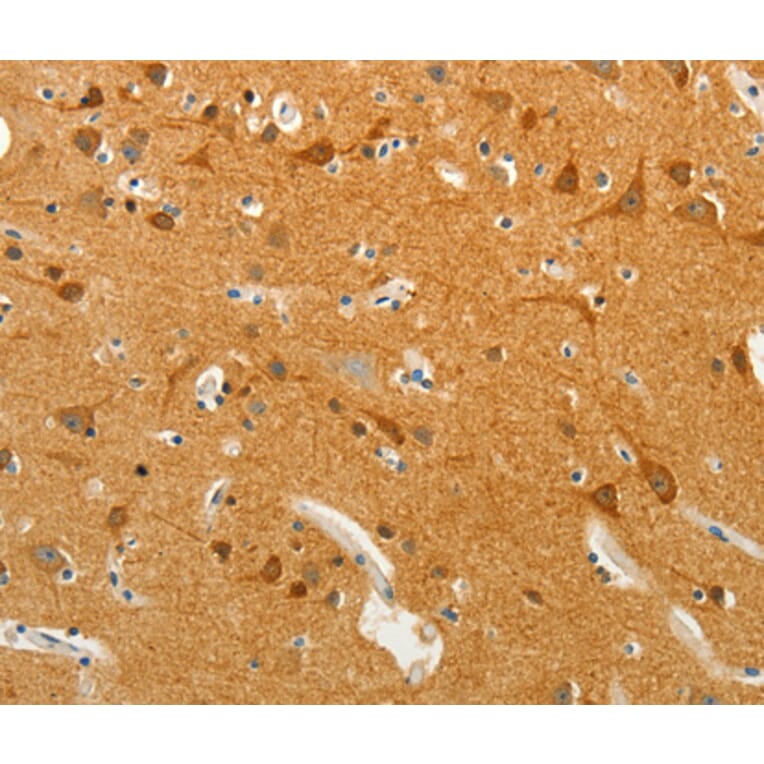 Anti-SLC18A2 Antibody from Bioworld Technology (BS7442) - Antibodies.com