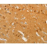 Anti-SLC18A2 Antibody from Bioworld Technology (BS7442) - Antibodies.com