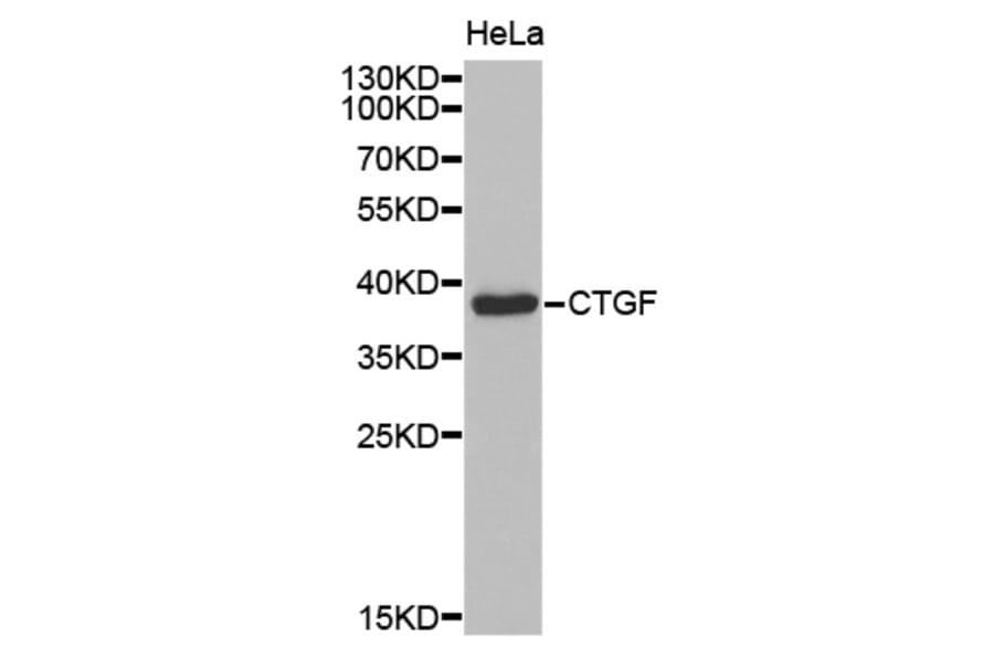 Anti-CTGF Antibody from Bioworld Technology (BS7445) - Antibodies.com