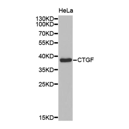 Anti-CTGF Antibody from Bioworld Technology (BS7445) - Antibodies.com