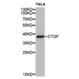 Anti-CTGF Antibody from Bioworld Technology (BS7445) - Antibodies.com