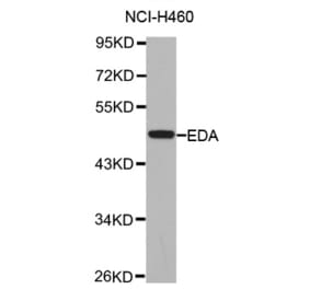 Anti-EDA Antibody from Bioworld Technology (BS7451) - Antibodies.com