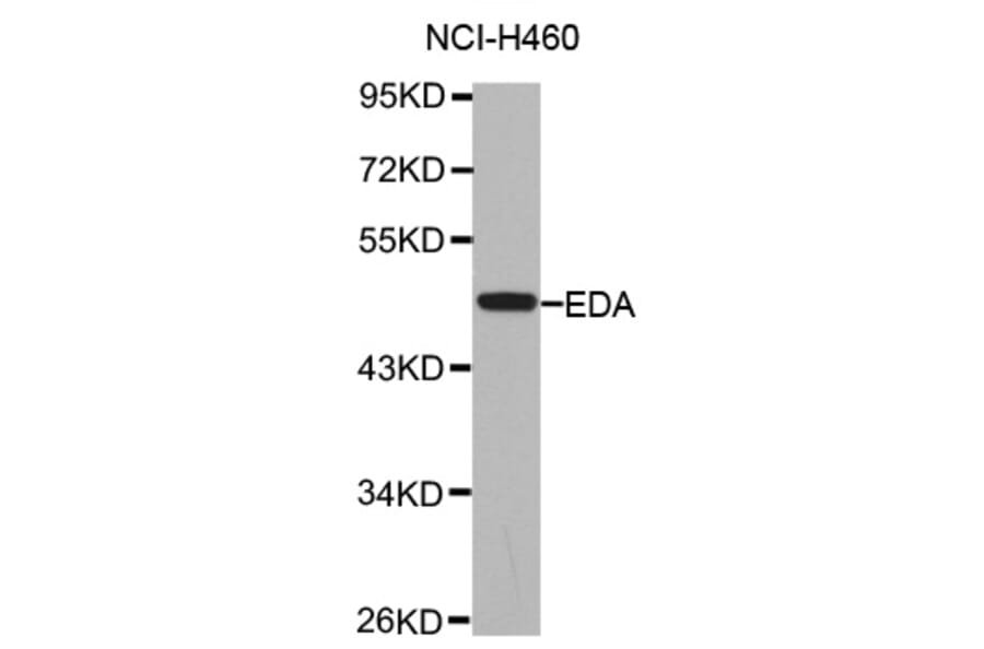 Anti-EDA Antibody from Bioworld Technology (BS7451) - Antibodies.com
