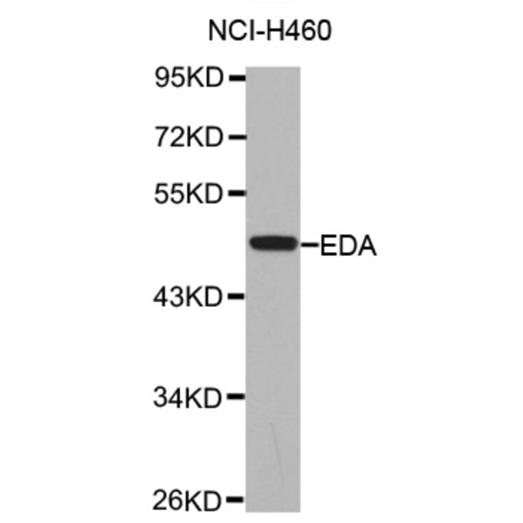 Anti-EDA Antibody from Bioworld Technology (BS7451) - Antibodies.com