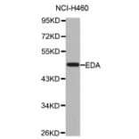 Anti-EDA Antibody from Bioworld Technology (BS7451) - Antibodies.com