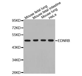 Anti-EDNRB Antibody from Bioworld Technology (BS7452) - Antibodies.com