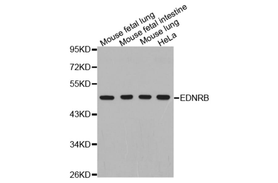 Anti-EDNRB Antibody from Bioworld Technology (BS7452) - Antibodies.com