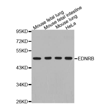 Anti-EDNRB Antibody from Bioworld Technology (BS7452) - Antibodies.com
