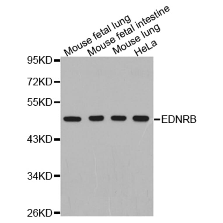 Anti-EDNRB Antibody from Bioworld Technology (BS7452) - Antibodies.com