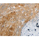 Anti-EDNRB Antibody from Bioworld Technology (BS7452) - Antibodies.com