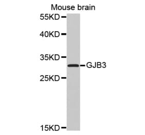 Anti-GJB3 Antibody from Bioworld Technology (BS7455) - Antibodies.com