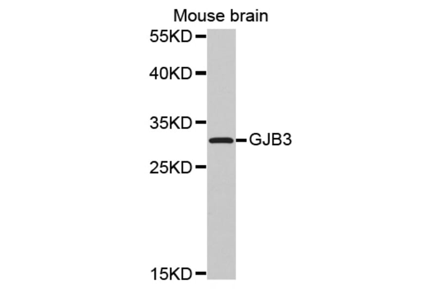Anti-GJB3 Antibody from Bioworld Technology (BS7455) - Antibodies.com