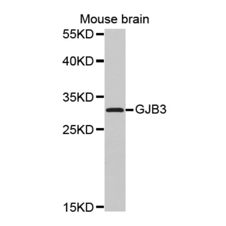 Anti-GJB3 Antibody from Bioworld Technology (BS7455) - Antibodies.com