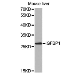 Anti-IGFBP1 Antibody from Bioworld Technology (BS7465) - Antibodies.com