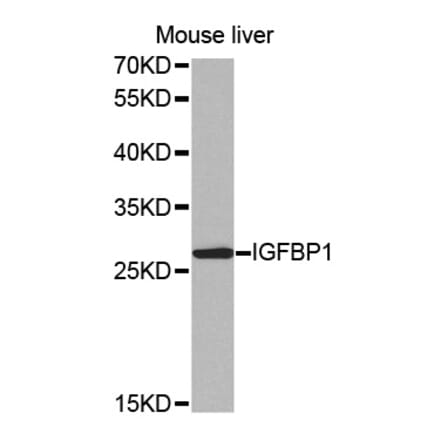 Anti-IGFBP1 Antibody from Bioworld Technology (BS7465) - Antibodies.com