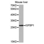 Anti-IGFBP1 Antibody from Bioworld Technology (BS7465) - Antibodies.com