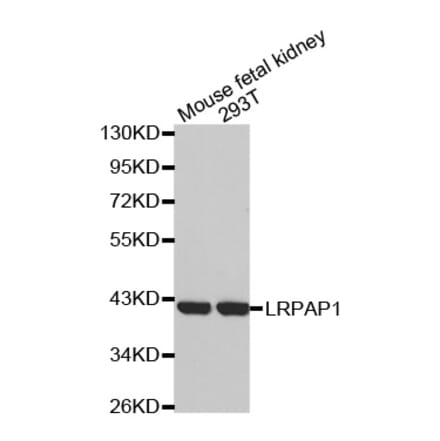 Anti-LRPAP1 Antibody from Bioworld Technology (BS7471) - Antibodies.com