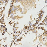 Anti-LRPAP1 Antibody from Bioworld Technology (BS7471) - Antibodies.com