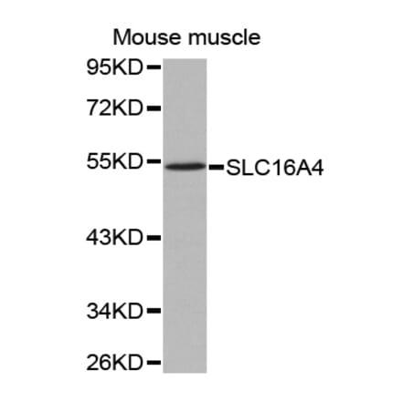 Anti-SLC16A4 Antibody from Bioworld Technology (BS7473) - Antibodies.com