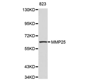 Anti-MMP25 Antibody from Bioworld Technology (BS7476) - Antibodies.com