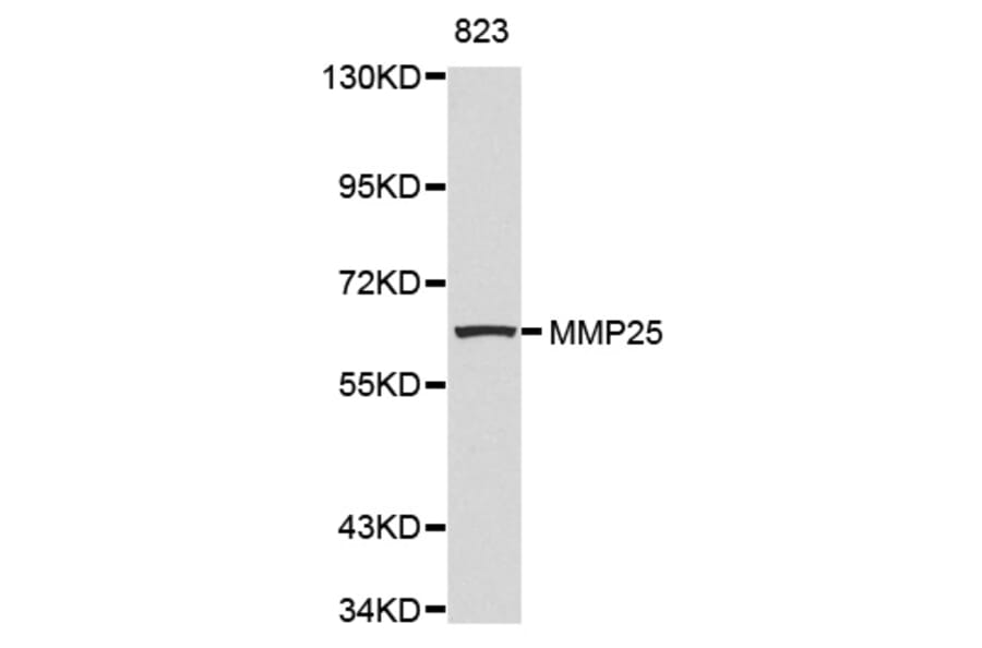 Anti-MMP25 Antibody from Bioworld Technology (BS7476) - Antibodies.com
