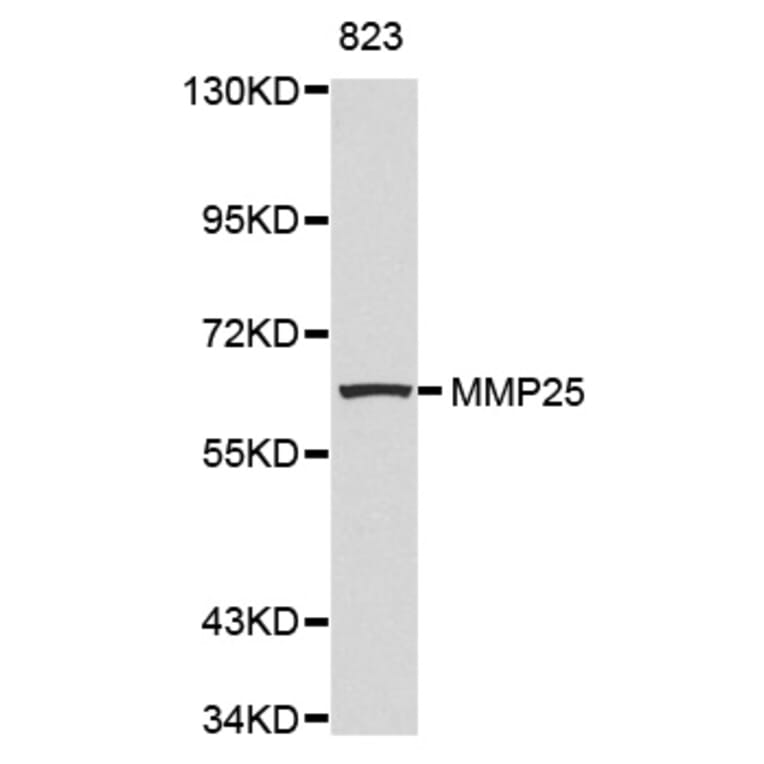 Anti-MMP25 Antibody from Bioworld Technology (BS7476) - Antibodies.com