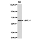 Anti-MMP25 Antibody from Bioworld Technology (BS7476) - Antibodies.com