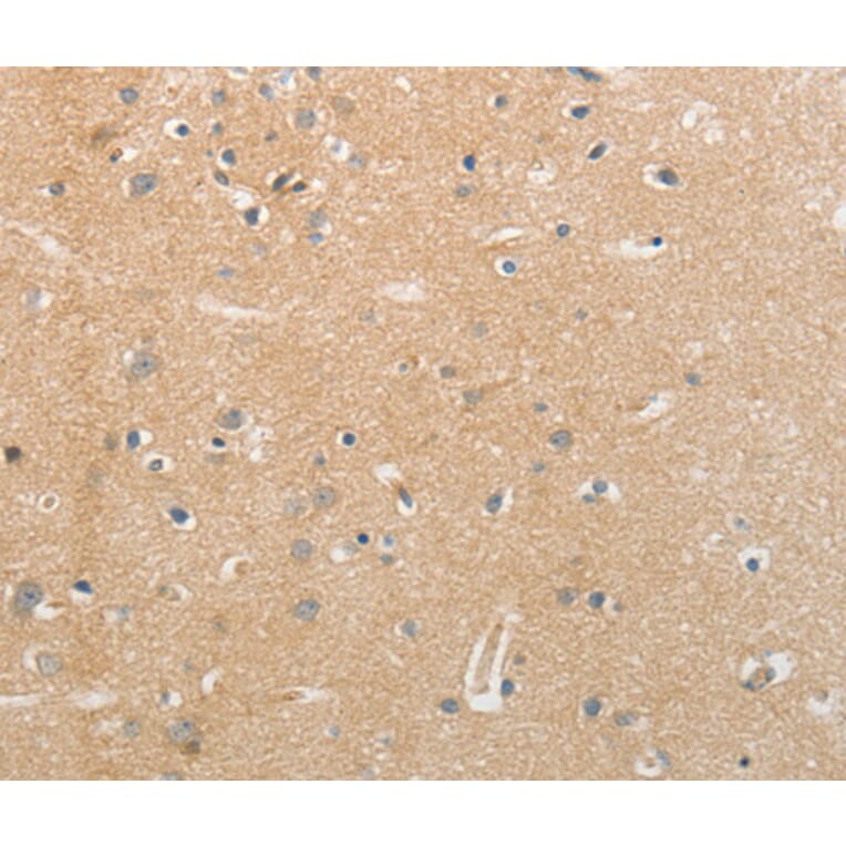 Anti-NFASC Antibody from Bioworld Technology (BS7478) - Antibodies.com