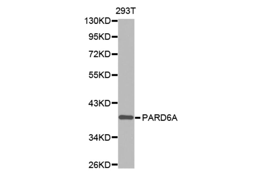 Anti-PARD6A Antibody from Bioworld Technology (BS7481) - Antibodies.com